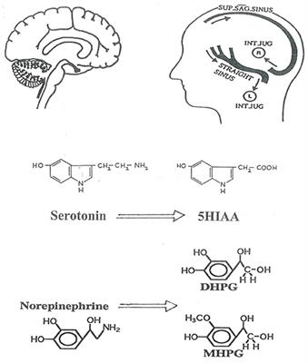 Measurement of Noradrenaline and Serotonin Metabolites With Internal Jugular Vein Sampling: An Indicator of Brain Monoamine Turnover in Depressive Illness and Panic Disorder
